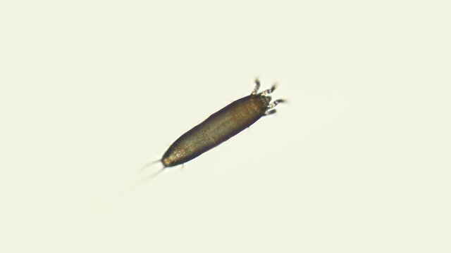 Gall mite (acari) Eriophyoidea under the microscope, order Trombidiformes, is a species of pests of forest and cultivated plants (apple trees, grapes, plums and others). Size 0.1-0.3 mm
