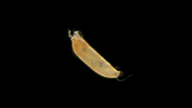 Gall mite (acari) Eriophyoidea under the microscope, order Trombidiformes, is a species of pests of forest and cultivated plants (apple trees, grapes, plums and others). Size 0.1-0.3 mm