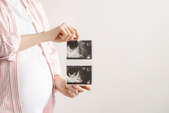 Pregnant woman with ultrasound result in hands on bright background with copyspace . Motherhood, medicine and love item