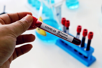 Fototapeta premium Concept corona virus vaccine simple for test solve COVID-19 in lab room at hospital.