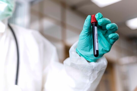 Medical concept; Close up picture of the doctor hold the tube of the blood sample for virus testing