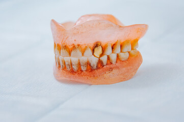 Close-up an acrylic denture prosthesis of the upper and lower jaws of a man