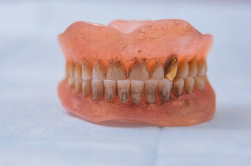 Close-up an acrylic denture prosthesis of the upper and lower jaws of a man