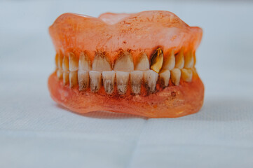 Close-up an acrylic denture prosthesis of the upper and lower jaws of a man