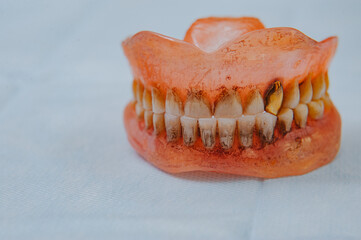 Close-up an acrylic denture prosthesis of the upper and lower jaws of a man