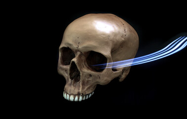 A realistic human prop skull with a missing lower jawbone.