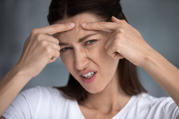 Fototapeta premium Anxious young woman feel unhappy with skin look in mirror squeeze pimple on forehead, worried dissatisfied millennial female frustrated with acne or wrinkle, cosmetology, skincare concept
