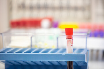 Fresh blood sample in a vial after taking a blood from a vein, medical concept