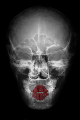 human skull ray