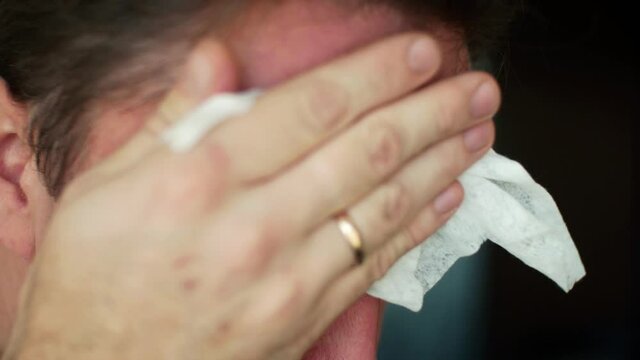 Tired Man wipes sweat. High blood pressure. The body response to heat close-up