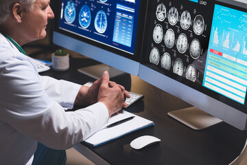 Senior neurologist with MRI scan of human head in clinic