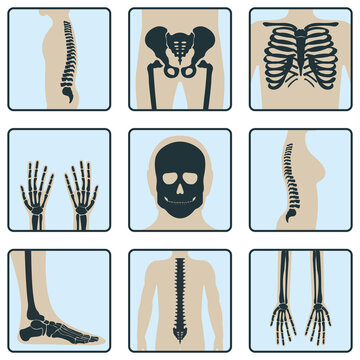 Set of bone, chest x-ray concept icon, roentgen human body image isolated on white, flat vector illustration. Skeleton part of man organism.