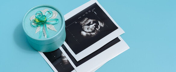 A gift and prints of sonogram.