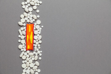 Atherosclerosis of blood vessels. Cholesterol in the arteries. Thrombosis treatment.