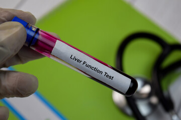 Liver Function Test text with blood sample. Top view isolated on black background. Healthcare/Medical concept