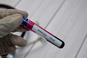 Obraz premium Allergy Test text with blood sample. Top view isolated on black background. Healthcare/Medical concept