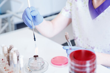 Microbiology hand medical working on agar plate culture bacteria and drug resistance of pathogens in laboratory and bacterial identification