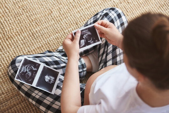Young mother waiting of the baby. Pregnant woman sitting on a rug, holding ultrasound image. Concept of pregnancy, health care, gynecology, medicine. Close-up, copy space, indoors, top view