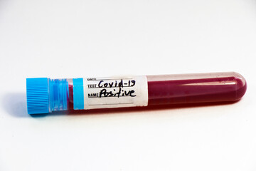 Corona virus positive test samples. Diagnosis and laboratory. Studio shoot, white background.
