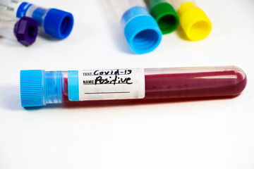 Corona virus positive test samples. Diagnosis and laboratory. Studio shoot, white background.