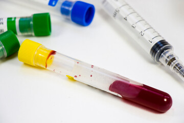 Blood test full tubes sample on the white background