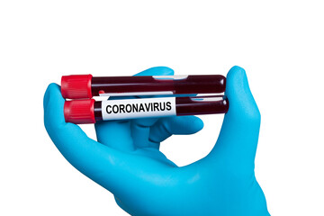 Coronavirus 2019-nCoV Blood Sample.