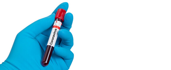 Coronavirus 2019-nCoV Blood Sample.