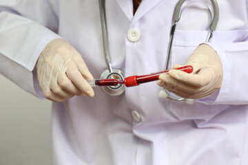 Doctor hand holding blood collection tubes in hematology laboratory, Medicine and science concept