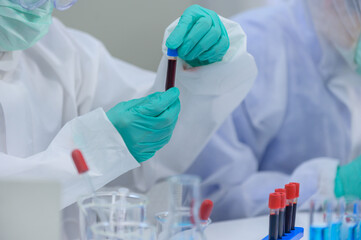 Scientist team has researching Coronavirus cure in the laboratory. Asian Doctor working on vaccine...