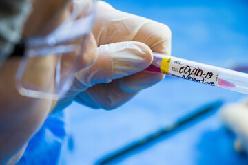 Corona virus negative test samples. Diagnosis and laboratory. Studio shoot, white background.