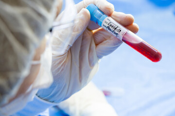 Corona virus positive test samples. Diagnosis and laboratory. Studio shoot, white background.