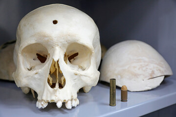 Human skull and traces of crime. Bones are like evidence.