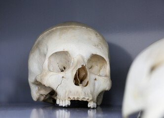 Human skull and traces of crime. Bones are like evidence.