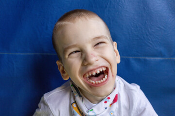 Boy with cerebral palsy in the conditions of his apartment. He reacts vividly to everything that happens around him and shows it with his personality. High quality photo