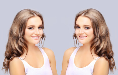 Rhinoplasty.Before and after	