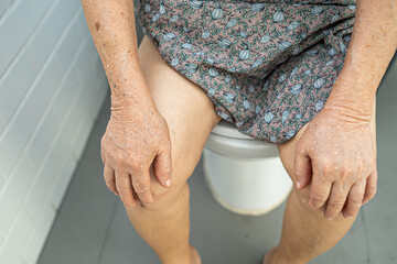 Asian senior or elderly old lady woman patient sitting on flush toilet to clean before and after use.