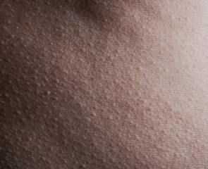 Pattern of human skin with bumps