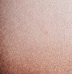White clean human skin