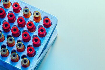 Tubes with blood samples on laboratory desk