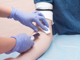 The doctor take blood from patient's hand. Blue gloves. Close up