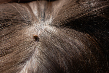 View on big tick (Ixodes) sucking blood from dog Border collie, hidden in the fur of the dog.