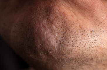 Fototapeta premium Close-up of the chin on the face of a man as a background.