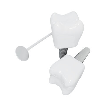 Dental Implants surgery concept, dentistry denture, Dental denture on white background. 3D render.