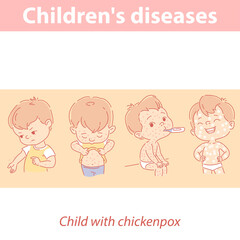 Children diseases. Baby with chicken pox set