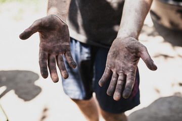 Dirty hands of worker miner are corns palms in abrasions. Concept hard work