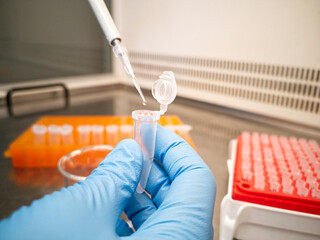 Lab technician in blue medical gloves using an electronic pipette to put liquid in an eppendorf....