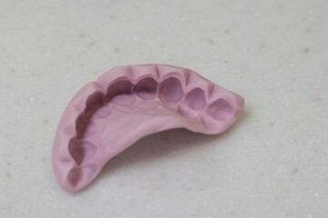 Surgical template, silicone impression of teeth in dentistry