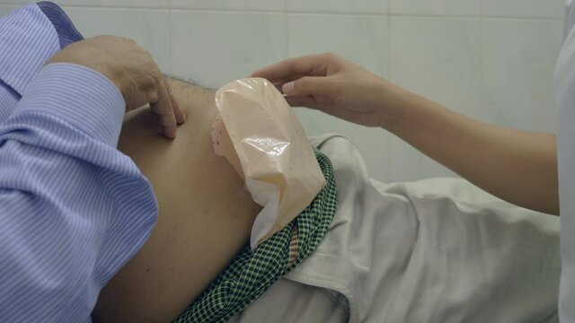 close up of an ostomy bag is a fairly simple device intended to rest the patient&rsquo;s colon.