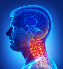 3d rendered, medically accurate illustration of male   having a painful neck