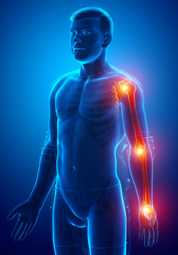 3d Illustration of men arm joint pain